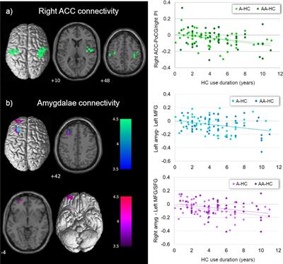 Hormonal contraceptive exposure relates to changes in resting state functional connectivity of anterior cingulate cortex and amygdala